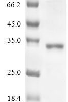 Human FAS-associated death domain protein (FADD) Recombinant Protein - BioCrest Sci