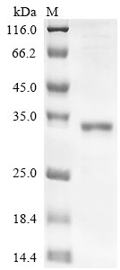 Human FAS-associated death domain protein (FADD) Recombinant Protein, Homo sapiens (Human), E.coli, C-terminal 6xHis-tagged, 30.2 kDa, purity >≥ 85% as determined by SDS-PAGE.
