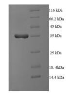 Human Serine/threonine-protein phosphatase 2A regulatory subunit B'' subunit beta (PPP2R3B) Recombinant Protein, N-His-SUMO - BioCrest Sci