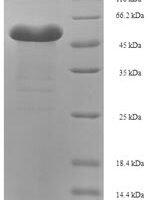 Entamoeba histolytica Pyruvate, phosphate dikinase (PPDK), partial Recombinant Protein - BioCrest Sci