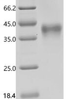 Mouse Tumor necrosis factor receptor superfamily member 4 (Tnfrsf4) Recombinant Protein - BioCrest Sci