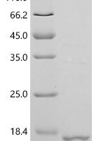 Porcine reproductive and respiratory syndrome virus GP5, partial Recombinant Protein, C-His - BioCrest Sci