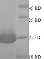 Rat Vesicle-fusing ATPase (Nsf), partial Recombinant Protein - BioCrest Sci