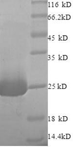 Rat Vesicle-fusing ATPase (Nsf), partial Recombinant Protein, Rattus norvegicus (Rat), E.coli, N-terminal 6xHis-tagged, 26.5 kDa, purity >≥ 90% as determined by SDS-PAGE.