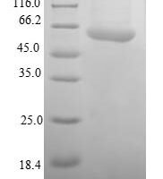 Human SUMO-activating enzyme subunit 1 (SAE1) Recombinant Protein - BioCrest Sci