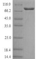 Human Galactocerebrosidase (GALC) Recombinant Protein, N-His - BioCrest Sci