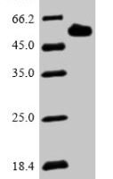 Human Dentin matrix acidic phosphoprotein 1 (DMP1) Recombinant Protein - BioCrest Sci