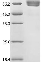 Macaca fascicularis Interleukin-4 receptor subunit alpha, partial Recombinant Protein - BioCrest Sci
