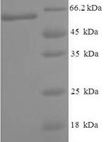 Human Cytoplasmic domain protein NCK2 (NCK2) Recombinant Protein - BioCrest Sci
