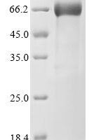 Human Kallikrein-9 (KLK9) Recombinant Protein - BioCrest Sci
