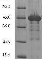 Human N-alpha-acetyltransferase 50 (NAA50) Recombinant Protein - BioCrest Sci