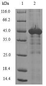 Human N-alpha-acetyltransferase 50 (NAA50) Recombinant Protein, Homo sapiens (Human), E.coli, N-terminal GST-tagged, 46.4 kDa, purity >≥ 90% as determined by SDS-PAGE.
