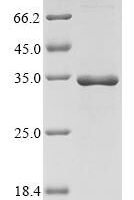 Serratia marcescens Metallo-beta-lactamase type 2 Recombinant Protein - BioCrest Sci