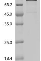 Human Protein-glutamine gamma-glutamyltransferase 2 (TGM2) (Y443G) Recombinant Protein - BioCrest Sci