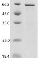 Human Angiopoietin-related protein 2(ANGPTL2) Recombinant Protein - BioCrest Sci