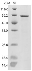 Human Angiopoietin-related protein 2(ANGPTL2) Recombinant Protein, Homo sapiens (Human), E.coli, C-terminal 6xHis-tagged, 61.7 kDa, purity >≥ 90% as determined by SDS-PAGE.