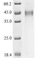 Human Inducible T-cell costimulator (ICOS), partial Recombinant Protein - BioCrest Sci