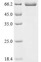 Human herpesvirus 1 Triplex capsid protein 2 (TRX2) Recombinant Protein, C-hFc1 - BioCrest Sci