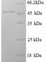 Rat Ephrin-A1 (Efna1) Recombinant Protein, N-GST - BioCrest Sci