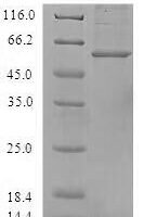 Human Annexin A8-like protein 2 (ANXA8L2) Recombinant Protein - BioCrest Sci