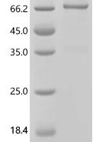 Human NACHT, LRR and PYD domains-containing protein 3 (NLRP3), partial Recombinant Protein, C-His, aa 1–536 - BioCrest Sci