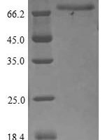 Human Fibulin-1 (FBLN1) Recombinant Protein, C-Myc/C-His - BioCrest Sci