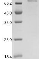 Human Lysyl oxidase homolog 1 (LOXL1) Recombinant Protein, N-His-SUMO - BioCrest Sci