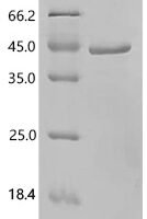 Human C-terminal-binding protein 2 (CTBP2), partial Recombinant Protein - BioCrest Sci