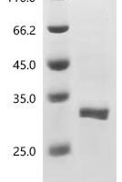 Mouse Neuronal acetylcholine receptor subunit alpha-7 (Chrna7) (C212A), partial Recombinant Protein - BioCrest Sci