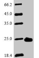 Human Peroxiredoxin-2 (PRDX2) Recombinant Protein, N-His - BioCrest Sci