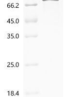 Human Junctional cadherin 5-associated protein (JCAD), partial Recombinant Protein - BioCrest Sci