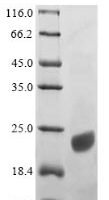 Human Apolipoprotein C-III (APOC3) Recombinant Protein - BioCrest Sci