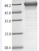 Chironex fleckeri Toxin CfTX-1 Recombinant Protein - BioCrest Sci