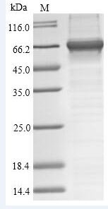 Chironex fleckeri Toxin CfTX-1 Recombinant Protein, Chironex fleckeri (Box jellyfish), E.coli, N-terminal 6xHis-SUMO-tagged, 65.1 kDa, purity >≥ 90% as determined by SDS-PAGE.