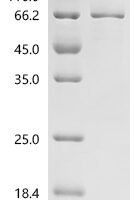Human Roundabout homolog 3 (ROBO3), partial Recombinant Protein, C-hFc1 - BioCrest Sci