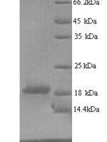 Human Ribonucleoprotein PTB-binding 2 (RAVER2), partial Recombinant Protein - BioCrest Sci