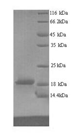 Human Ribonucleoprotein PTB-binding 2 (RAVER2), partial Recombinant Protein, Homo sapiens (Human), Yeast, N-terminal 6xHis-tagged, 17.0 kDa, purity >≥ 90% as determined by SDS-PAGE.
