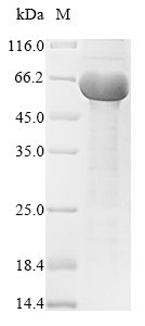 Mycobacterium tuberculosis Immunogenic protein MPT64 (mpt64) Recombinant Protein, C-His, Mycobacterium tuberculosis (strain ATCC 25618 / H37Rv), Baculovirus, C-terminal 6xHis-tagged, 23.5 kDa, purity >≥ 85% as determined by SDS-PAGE.