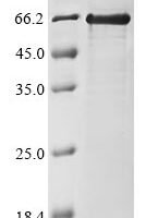 Xenopus laevis Polyribonucleotide 5-hydroxyl-kinase Clp1 (clp1) Recombinant Protein - BioCrest Sci