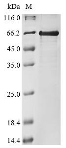 Xenopus laevis Polyribonucleotide 5-hydroxyl-kinase Clp1 (clp1) Recombinant Protein, Xenopus laevis (African clawed frog), E.coli, N-terminal 6xHis-tagged, 54.3 kDa, purity >≥ 85% as determined by SDS-PAGE.