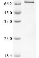 Human Paired box protein Pax-7(PAX7) Recombinant Protein - BioCrest Sci