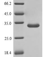 Human Ribonuclease 4 (RNASE4) Recombinant Protein, N-His-SUMOstar - BioCrest Sci