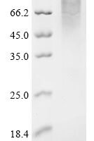 Saccharomyces cerevisiae Chromatin assembly factor 1 subunit p60 (CAC2) Recombinant Protein - BioCrest Sci
