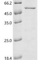 Human Dual specificity mitogen-activated protein kinase kinase 1 (MAP2K1) Recombinant Protein - BioCrest Sci