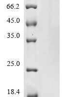 Human coronavirus HKU1 Non-structural protein 4 (4) Recombinant Protein, C-His, aa 1–109, Yeast, UniProt Q5MQC9 - BioCrest Sci