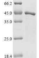 Human E3 ubiquitin-protein ligase CHIP (STUB1) Recombinant Protein, C-His - BioCrest Sci