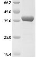 Human Tyrosine-protein kinase BTK (BTK)(M437R), partial Recombinant Protein - BioCrest Sci