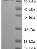 Chicken Vitellogenin-2 (VTG2), partial Recombinant Protein - BioCrest Sci