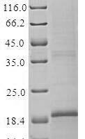 Rat Glucagon-like peptide 1 receptor (Glp1r), partial Recombinant Protein, N-His - BioCrest Sci