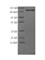 Human Granulocyte colony-stimulating factor receptor (CSF3R), partial Recombinant Protein, N-GST - BioCrest Sci